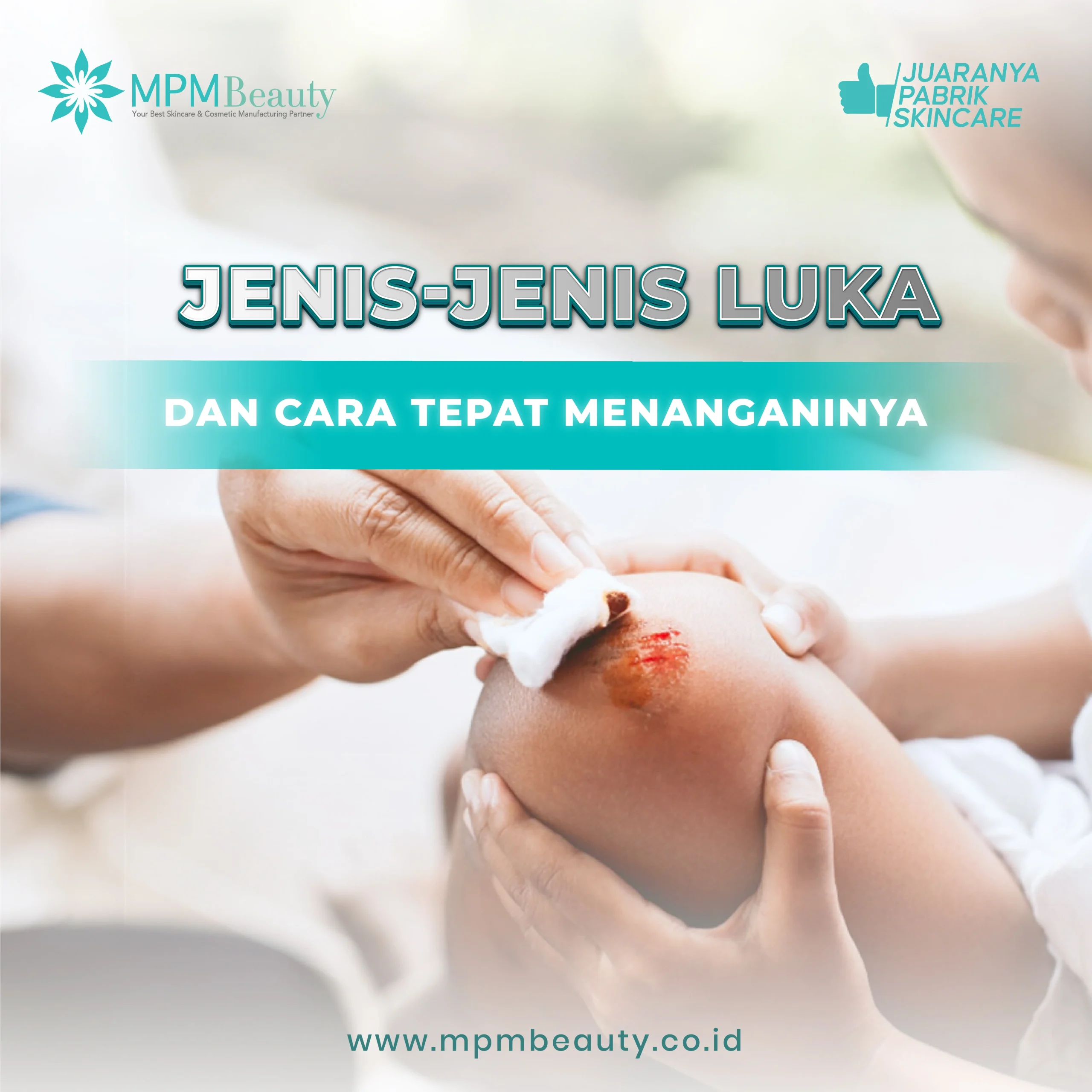 Jenis Luka