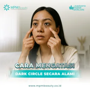 Cara Mengatasi Dark Circle
