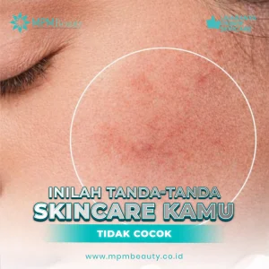 tanda Skincare Tidak Cocok