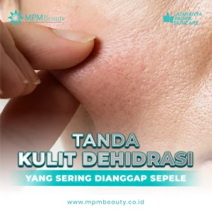 Tanda Kulit Dehidrasi