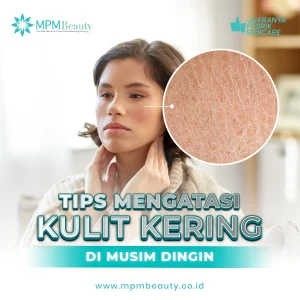 Tips Mengatasi Kulit Kering di Musim Dingin