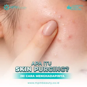 Skin Purging
