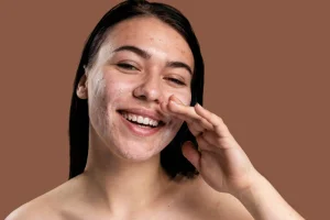 Panduan Membuat Skincare Acne Care