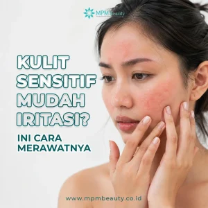 Kulit Sensitif
